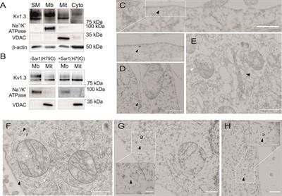 The Mitochondrial Routing of the Kv1.3 Channel